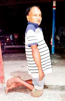 প্রতিবন্ধী মাসুদের কষ্টের জীবন