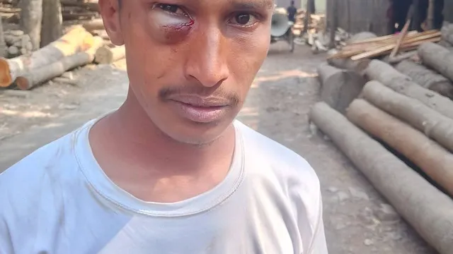 জামায়াতের প্রচারণা করায় ভ্যানচালককে হাতুড়ি দিয়ে হামলা বিএনপি নেতাকর্মীদের