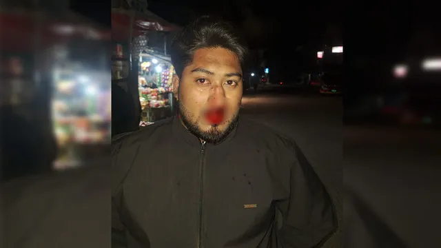 জুড়ীতে বিএনপি প্রার্থীর নেতৃত্বে জামায়াতের নেতাকর্মীর উপর হামলা, আহত ৫