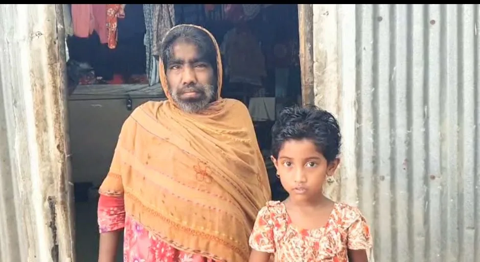 মানুষ নয় যেন ভয়ের প্রতীক লোম মানব পরিবার