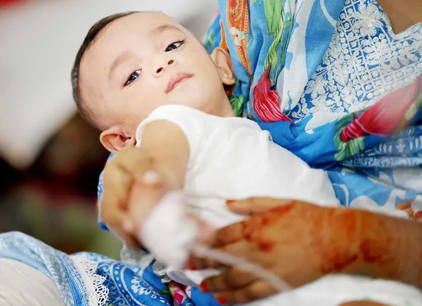 হাম ও উপসর্গে মৃত্যু বেড়ে দাঁড়াল ৬৪৩ জনে