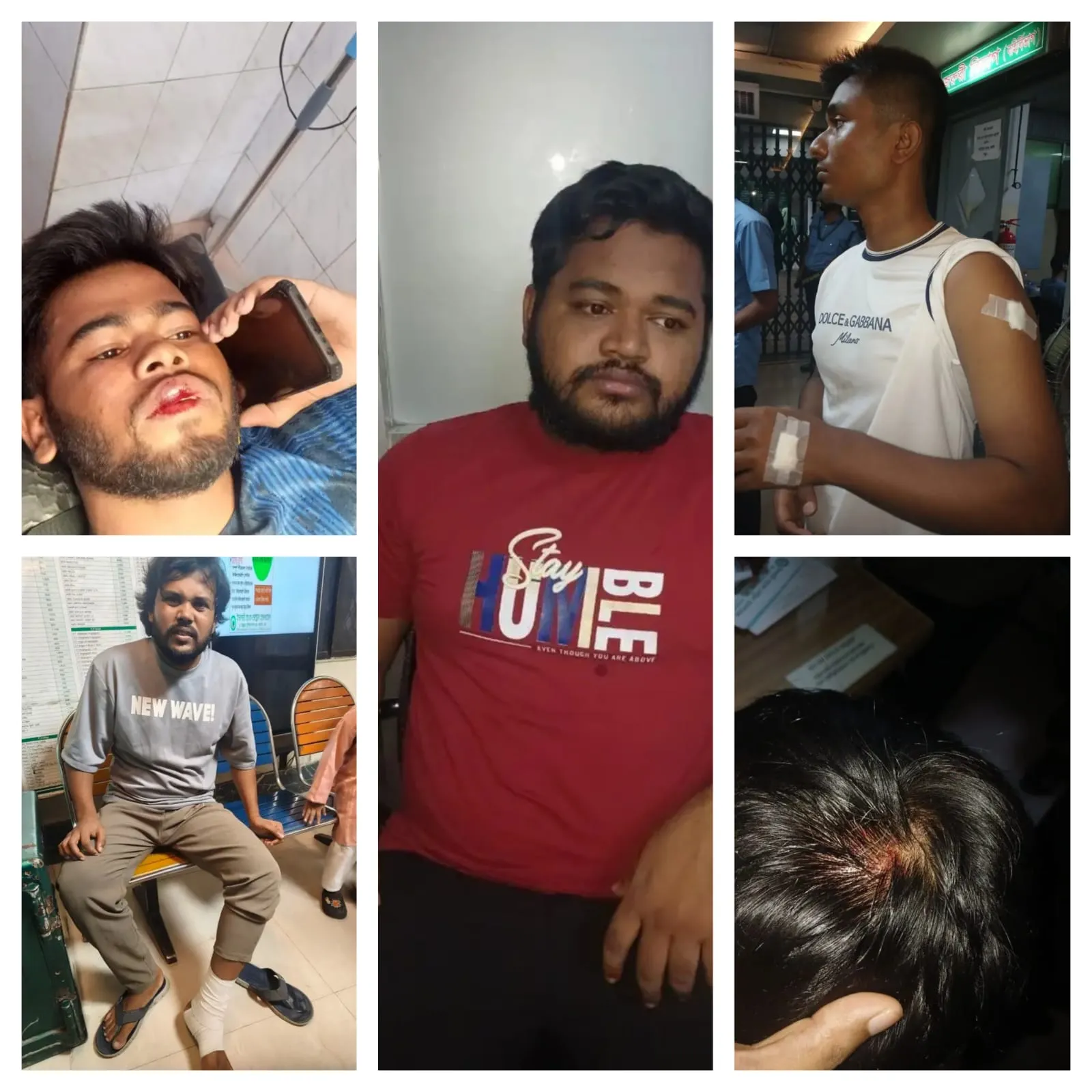 সিদ্ধেশ্বরী কলেজে ছাত্রদলের দফায় দফায় হামলায় শিবিরের ৫ নেতাকর্মী আহত