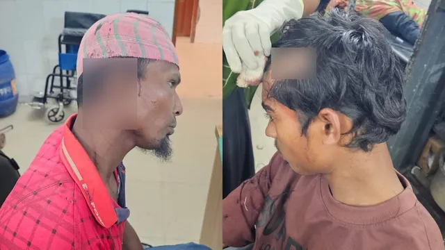 বাগেরহাটের শরণখোলায় বিএনপির হামলায় জামায়াতের ১৫ নেতাকর্মী আহত