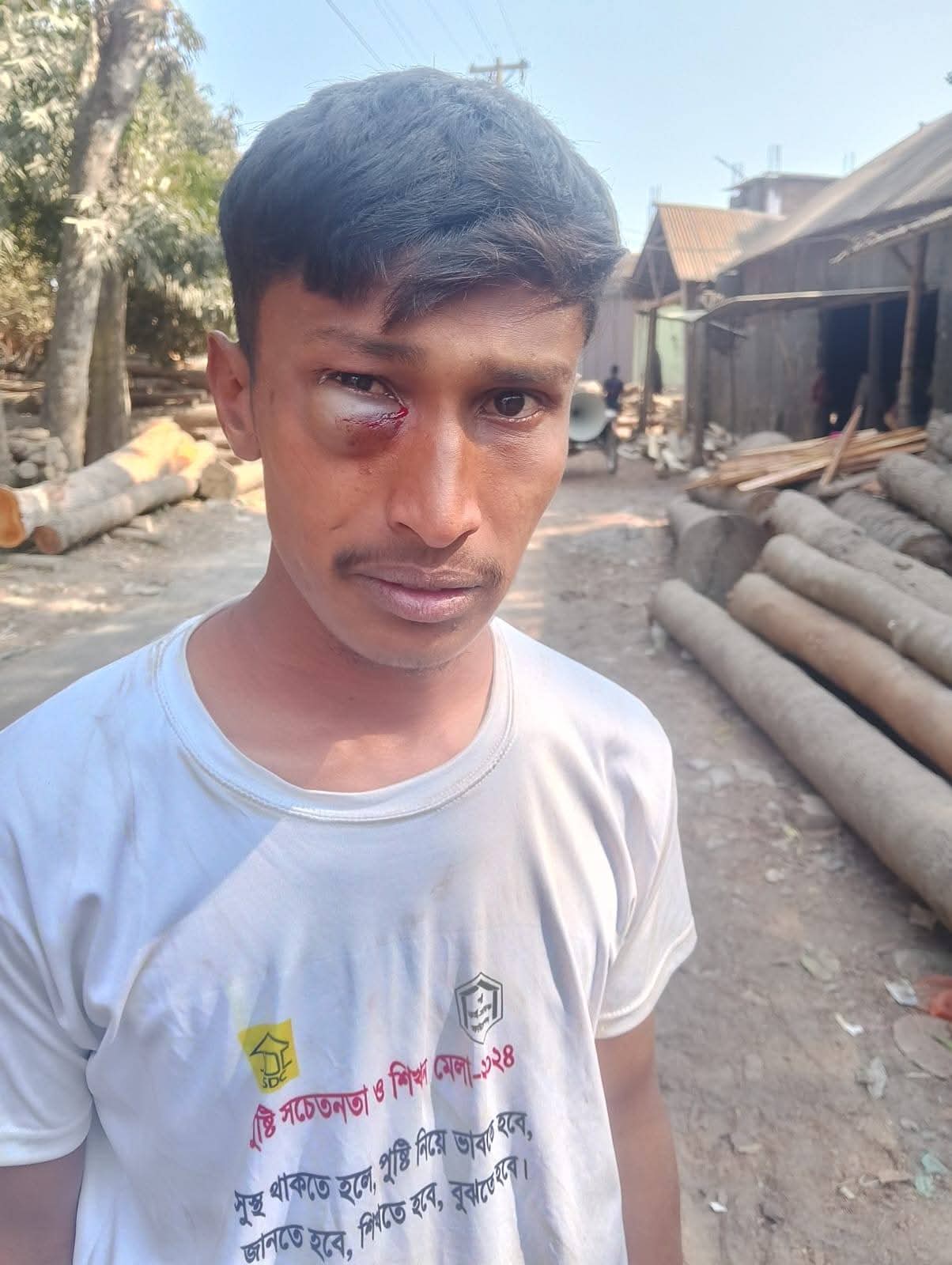 আহত ভ্যানচালক মো. জাহিদ